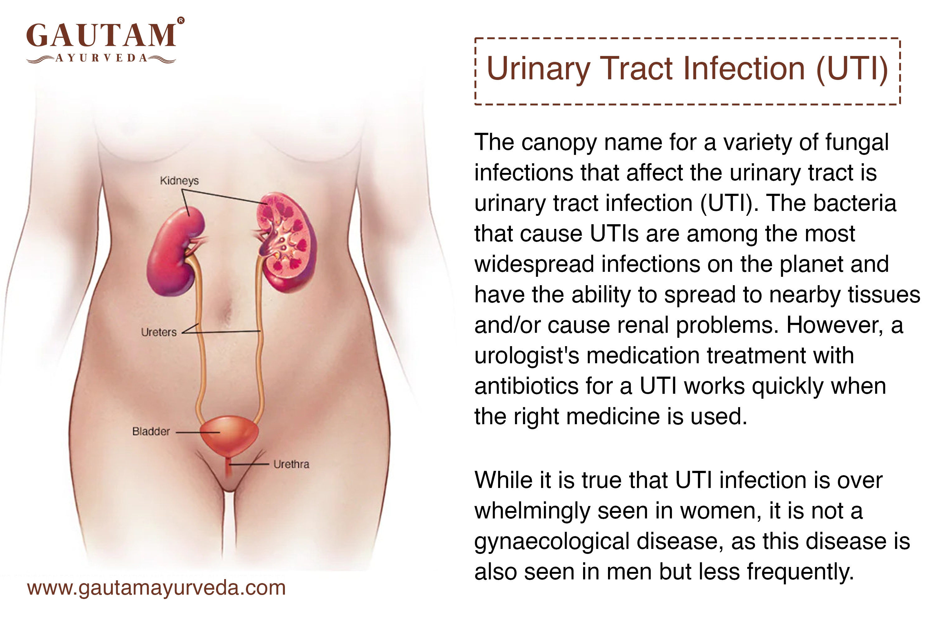 Urinary Tract Infections